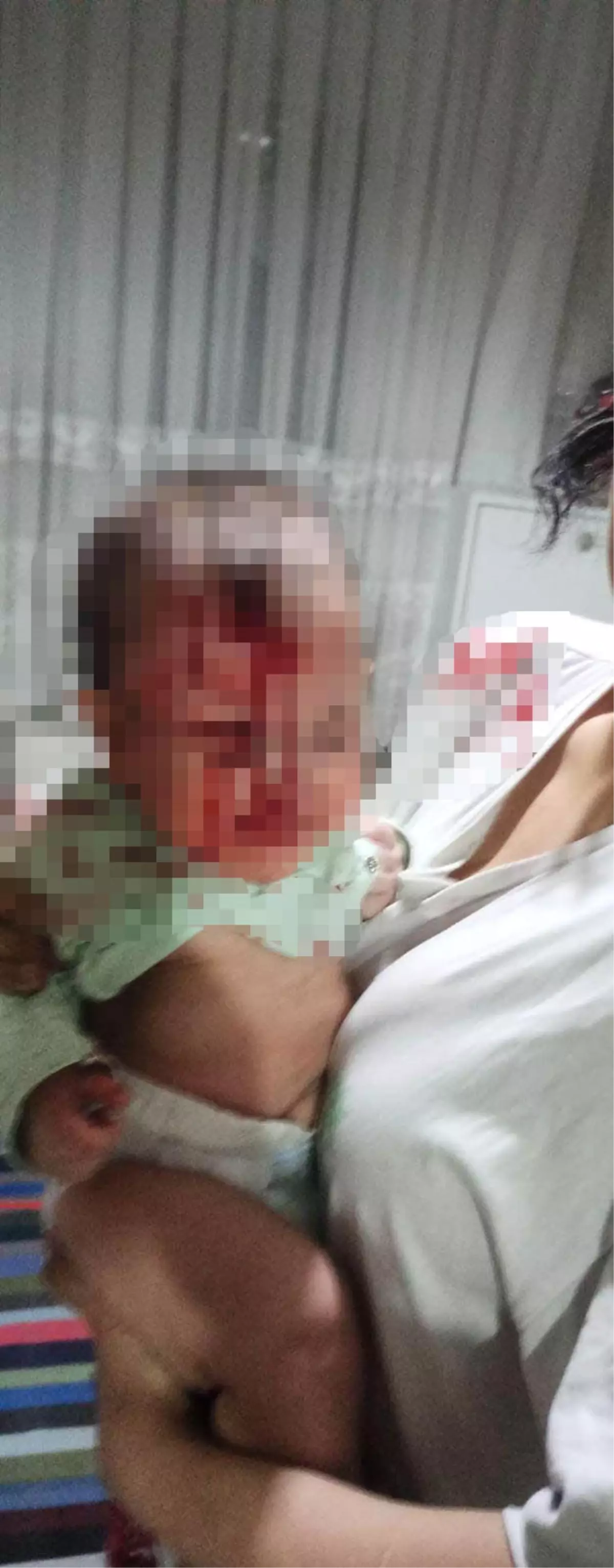 Baba, 4 Aylık Bebeğini Cam Sehpanın Üzerine Attı